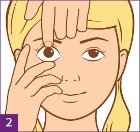 Schritt 2: Bereite Dich vor, die Kontaktlinse abzusetzen