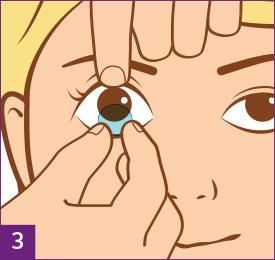 Schritt 3: Kontaktlinsen absetzen